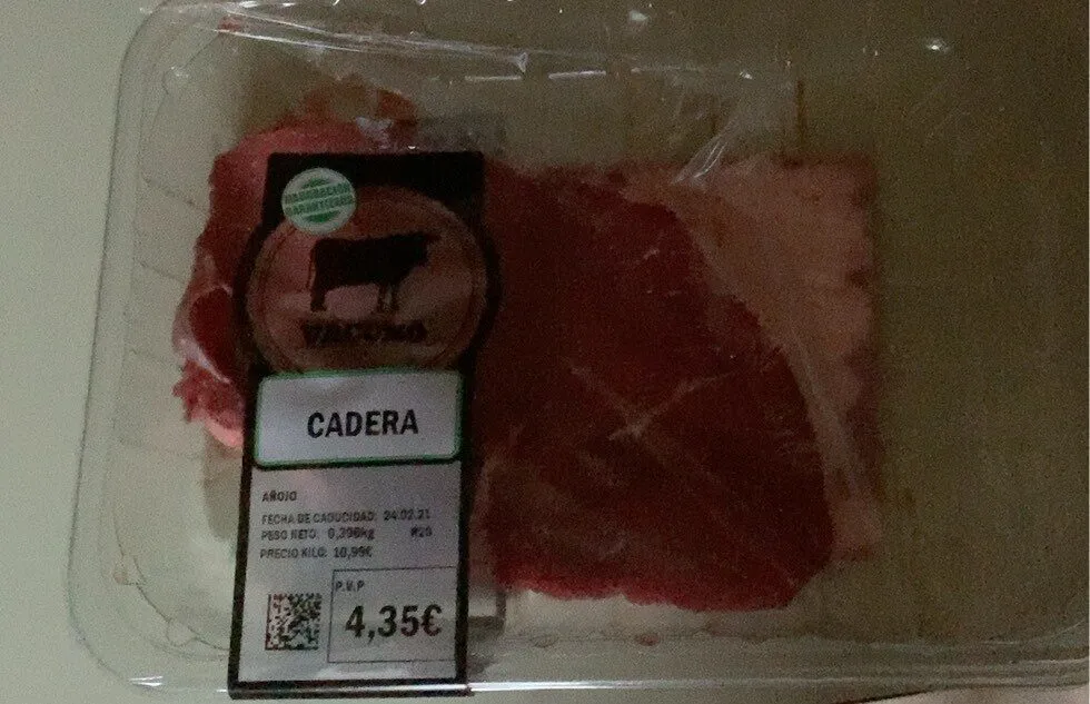 Cadera