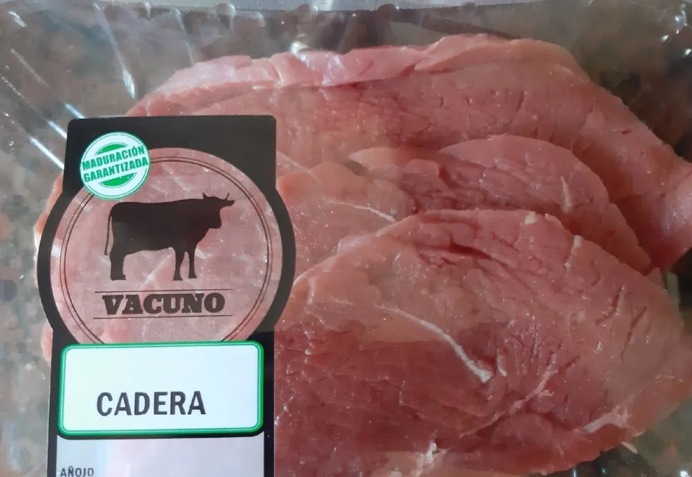 Cadera