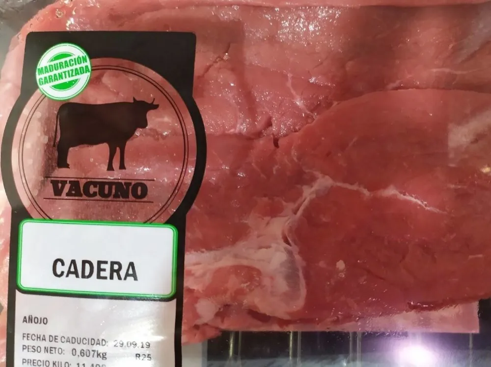 Cadera