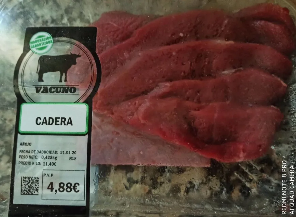 Cadera