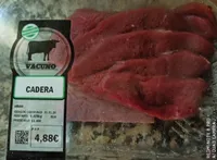 Cadera