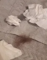 Apres un rhume et une calvitie