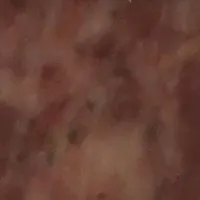 Farce à légumes