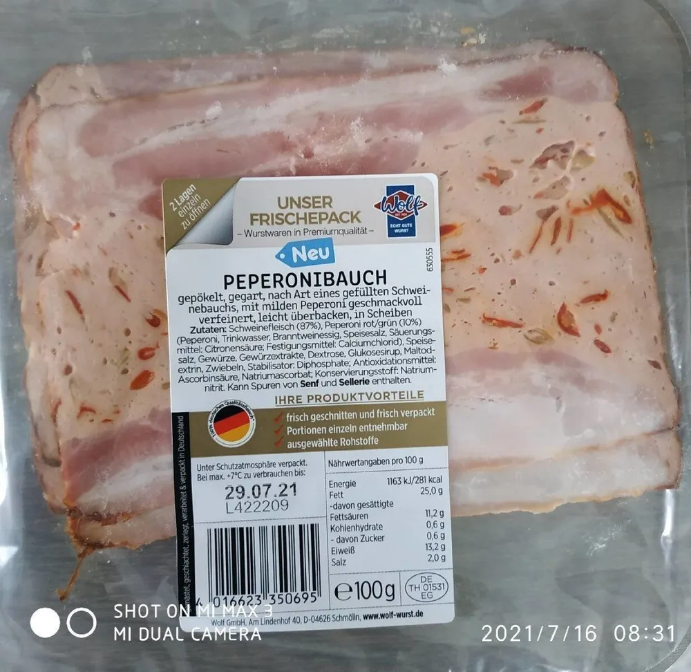 Prperonibauch
