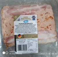 Prperonibauch