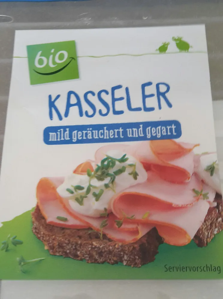 Kasseler