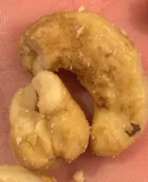 Anacardi