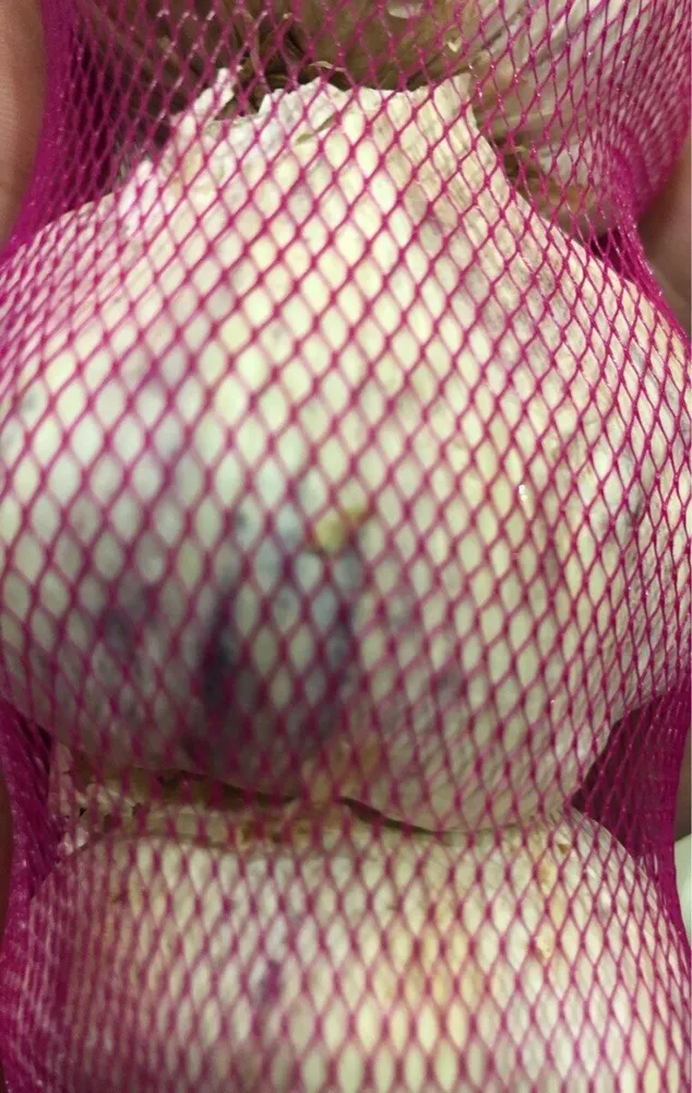 Ajo morado